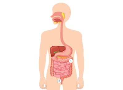 Colostomy diagram