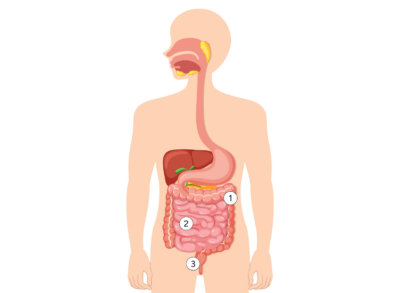 Ileostomy diagram