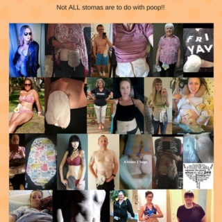 Urostomy Awareness Campaign