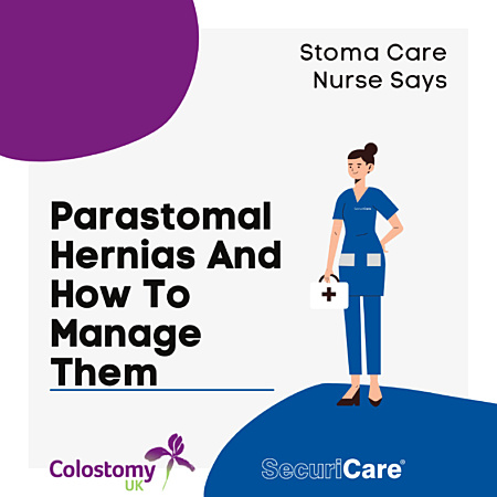 parastomal_hernia_and_how_to_manage_them_bloghero_1080x1080