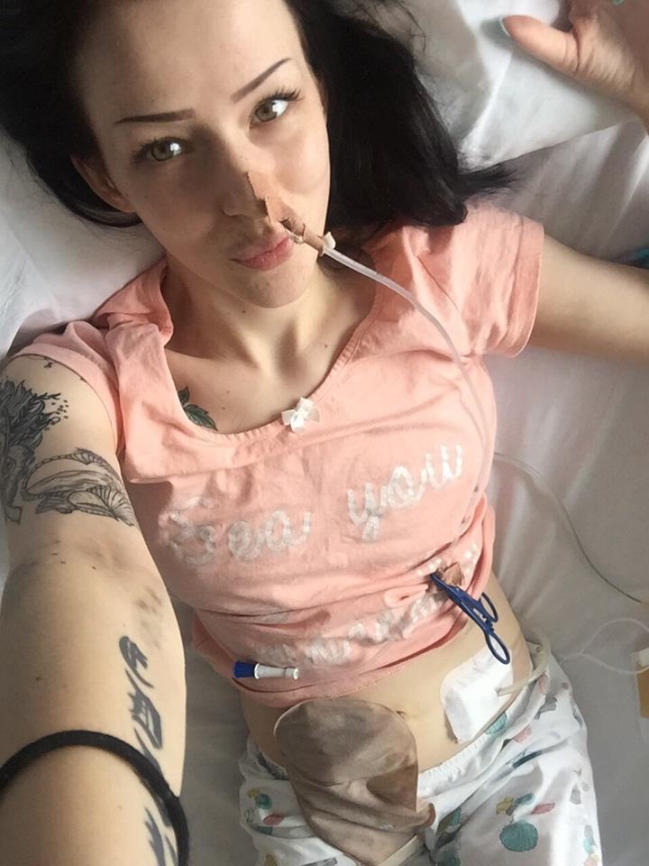 Rachael with a nasal gastric tube on a bed in Hospital