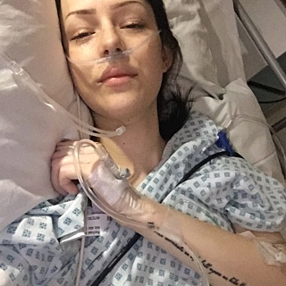 Rachael With A Stoma
