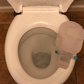 How Do You Empty Your Stoma Bag